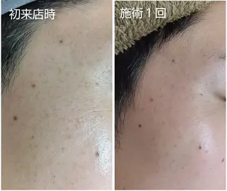 シミケア専門店 HAQUAのその他イメージ