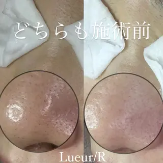 大久保 里奈のエステ・リラクイメージ