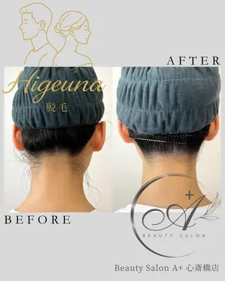 BeautysalonA所属・うなじ脱毛/ つや肌ハーブのエステ・リラクイメージ