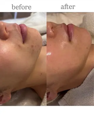 anthes /MIHOのエステ・リラクイメージ