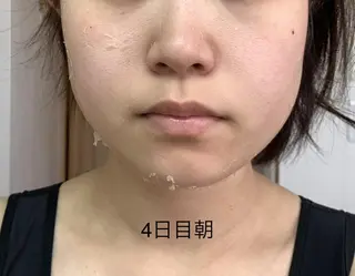 U24限定クーポン レイビス池袋MANAのエステ・リラクイメージ