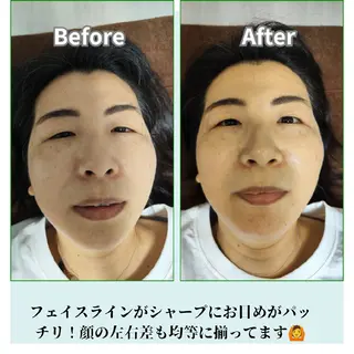 美容鍼サロン　それいゆ所属・鍼灸サロンそれいゆ 石河佳恵のエステ・リラクイメージ