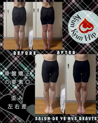 ヴィーナス ビューティーのエステ・リラクイメージ