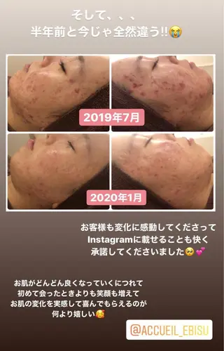 ミディアム カラー パーマ ヘアアレンジ メンズ キッズ ネイル マツエク・マツパ ニキビ・肌質改善専門 ♡人生が変わるサロンのエステ・リラクイメージ