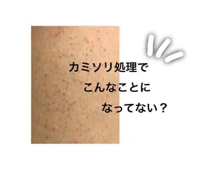 地上のトレチカ sugaringのエステ・リラクイメージ