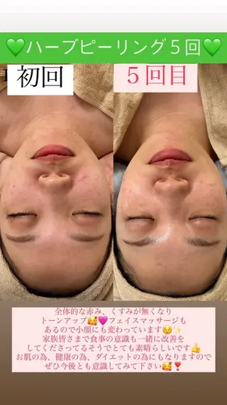 メンズ Salon de Lino 御器所のエステ・リラクイメージ