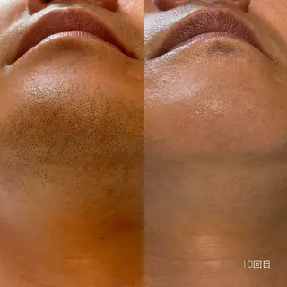 メンズ Lassy Yuriの眉毛・アイブロウイメージ