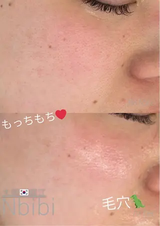 韓国🇰🇷価格 サロン_Nbibiのエステ・リラクイメージ