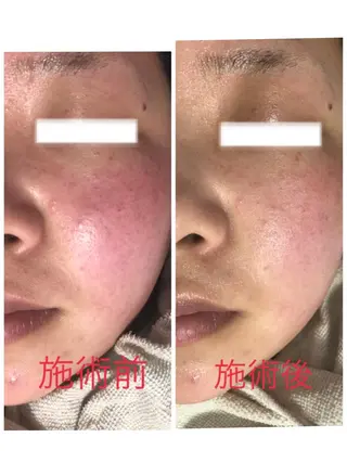 小顔・毛穴・たるみ ネイル　似内真樹のエステ・リラクイメージ