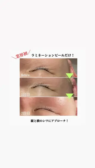 beautysalon RAVIS所属・東大阪/韓国肌管理/ 痩身バスト専門店のエステ・リラクイメージ