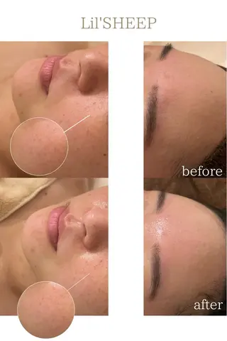 小嶋萌 今池駅徒歩2分のエステ・リラクイメージ