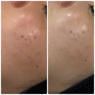 クラスペディア脱毛 ・フェイシャル専門店のエステ・リラクイメージ