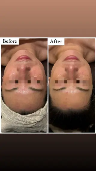 ハーブピーリング専門 muro.のエステ・リラクイメージ