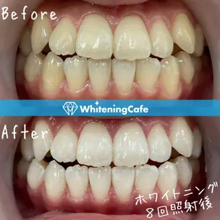 ホワイトニングカフェ神戸元町店所属・ホワイトニングカフェ 神戸元町店のエステ・リラクイメージ