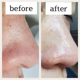 Makana_aloha所属・毛穴専門店 マカナアロハのエステ・リラクイメージ