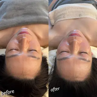 うなじ脱毛/美肌脱毛 LABELのエステ・リラクイメージ