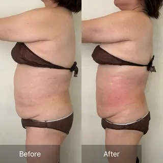 Charis エステ&ネイルのエステ・リラクイメージ