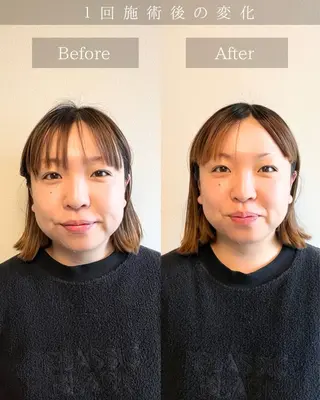 Noelie所属・美肌&小顔矯正 Noelieのエステ・リラクイメージ