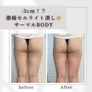 小顔矯正専門店 【RED】池田のエステ・リラクイメージ