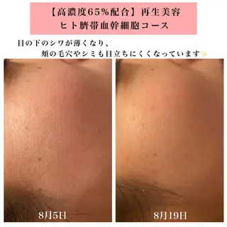 Bellesthe （ベルエステ）のエステ・リラクイメージ