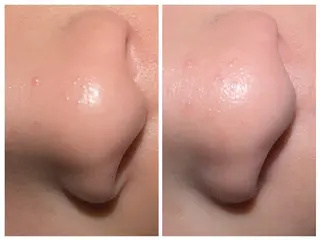 AQUAサロン AKALA所属・巡 (Meguri)のエステ・リラクイメージ