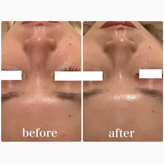 Lily branc 痩身/小顔/肌質改善のエステ・リラクイメージ