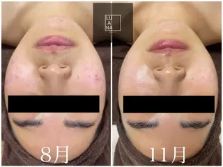 LUANA TAKAGIの眉毛・アイブロウイメージ