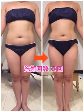 ロング カラー パーマ ヘアアレンジ メンズ キッズ ネイル マツエク・マツパ ‍痩身＆ボディ 結果出し🌟丹野のエステ・リラクイメージ