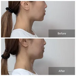 nail RiRi アトレナチュラのエステ・リラクイメージ