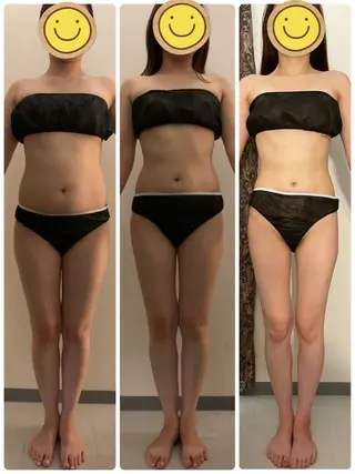 高速脱毛エステ リアンのエステ・リラクイメージ