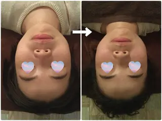 EXTR所属・EXTR エクスターのエステ・リラクイメージ