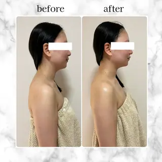 エステサロン　イデアルMe大宮店所属・イデアルMe♡ KIMISHIMAのその他イメージ