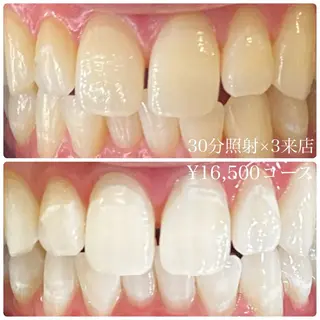 メンズ ホワイトニングルーム　川崎店所属・ホワイトニング ルーム　川崎店のその他イメージ