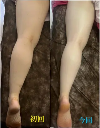 アロマ･美容鍼･カッ ピング「麗」鍼灸院のエステ・リラクイメージ