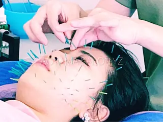 小顔美容鍼専門サロン 渋谷YZのその他イメージ