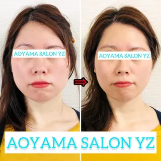 小顔美容鍼専門サロン 渋谷YZのエステ・リラクイメージ