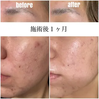 eve beauty salon所属・毛穴改善サロン CALLAのエステ・リラクイメージ