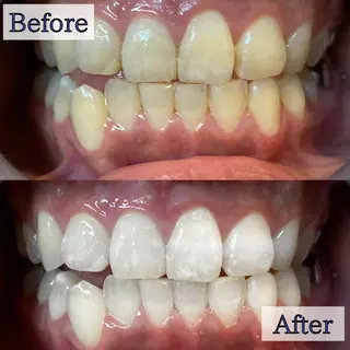 LBSホワイトニング 新宿店💝店長熊倉のエステ・リラクイメージ