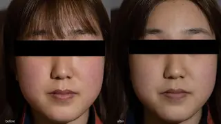 中山 秀展のエステ・リラクイメージ