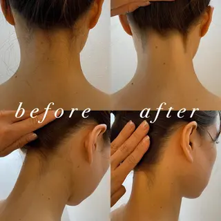 うなじ脱毛/美肌脱毛 LABELのエステ・リラクイメージ