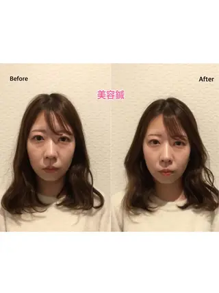 チキバン美容鍼灸整体 サロン心斎橋店のエステ・リラクイメージ