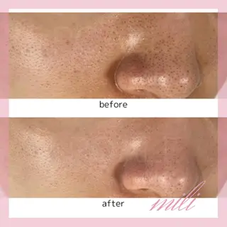 【毛穴ケア専門店✨】 mili 須藤歩華のエステ・リラクイメージ