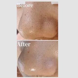 韓国肌管理 【毛穴専科】のエステ・リラクイメージ