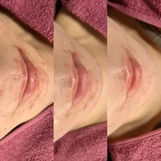 脱毛和みサロン新茶屋所属・脱毛和みサロン新茶屋 ひろみ（女性専用）のエステ・リラクイメージ