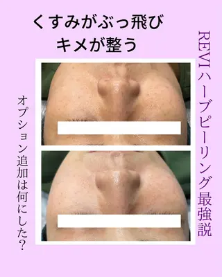 Ciel所属・徳増 美寿のエステ・リラクイメージ