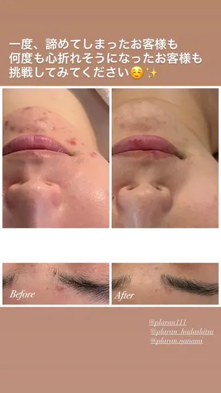 Plaran 〜プララン 〜のその他イメージ