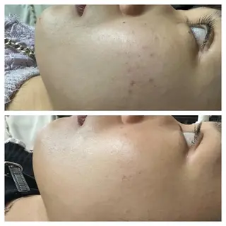 salonSHE° 新宿店🩵NINAのエステ・リラクイメージ