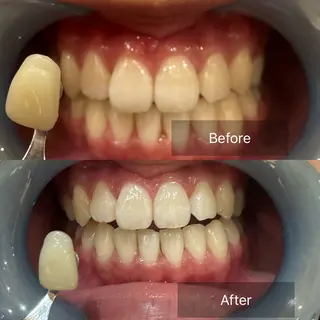 Ocouture所属・Ocouture ホワイトニング、小顔のその他イメージ