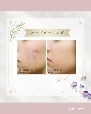 《 肌質×美肌 》 addissimoのエステ・リラクイメージ