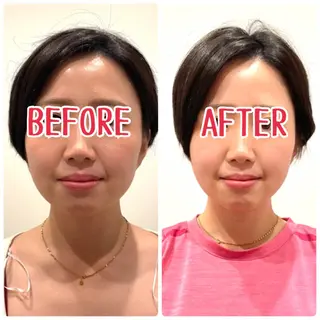 ジェイペック所属・整体×美容鍼 ジェイペックのエステ・リラクイメージ